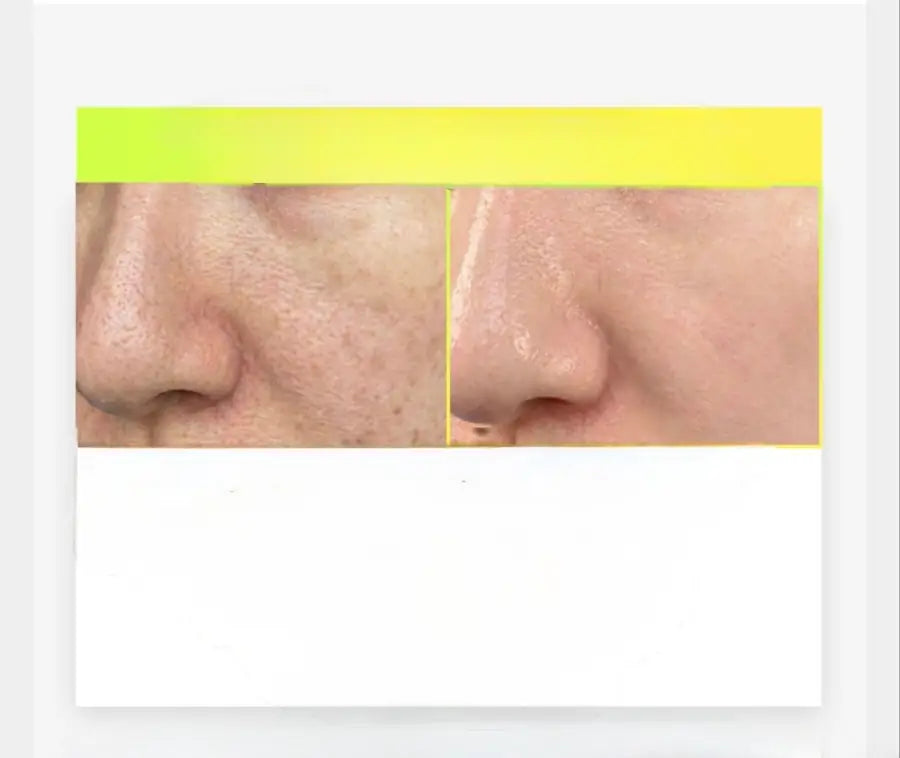 Arencia C Vitamini Booster Shot 30 ml