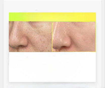 Arencia C Vitamini Booster Shot 30 ml