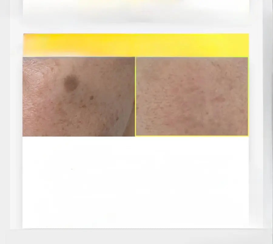 Arencia C Vitamini Booster Shot 30 ml