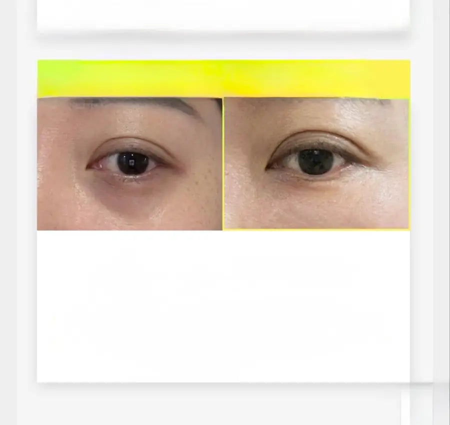 Arencia C Vitamini Booster Shot 30 ml